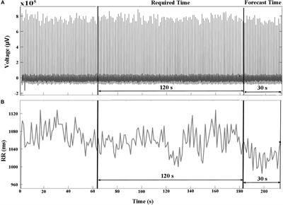 Machine Learning Approach to Predict Ventricular Fibrillation Based on QRS Complex Shape